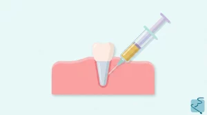 factores de crecimiento plaquetario en odontologia