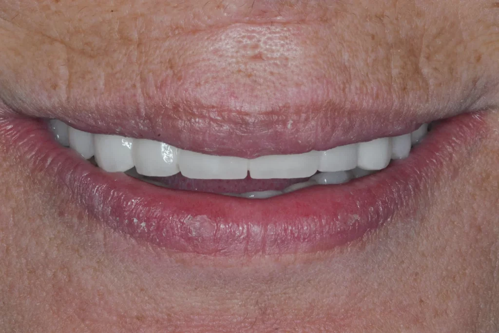 Clinica dental Sevilla