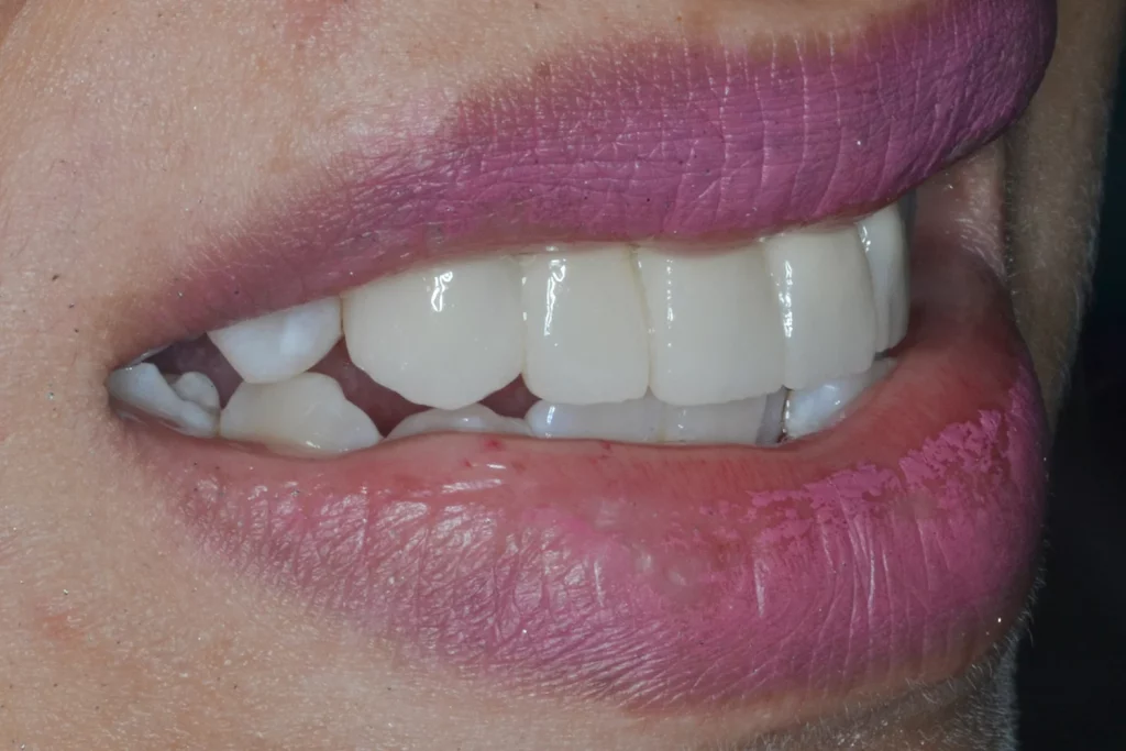 Clinica dental Sevilla