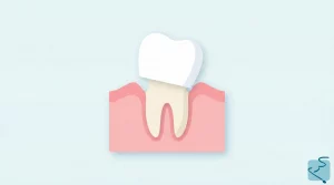 corona dental mal puesta