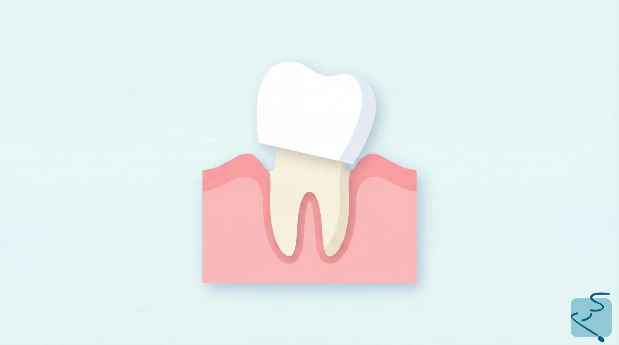 corona dental mal puesta