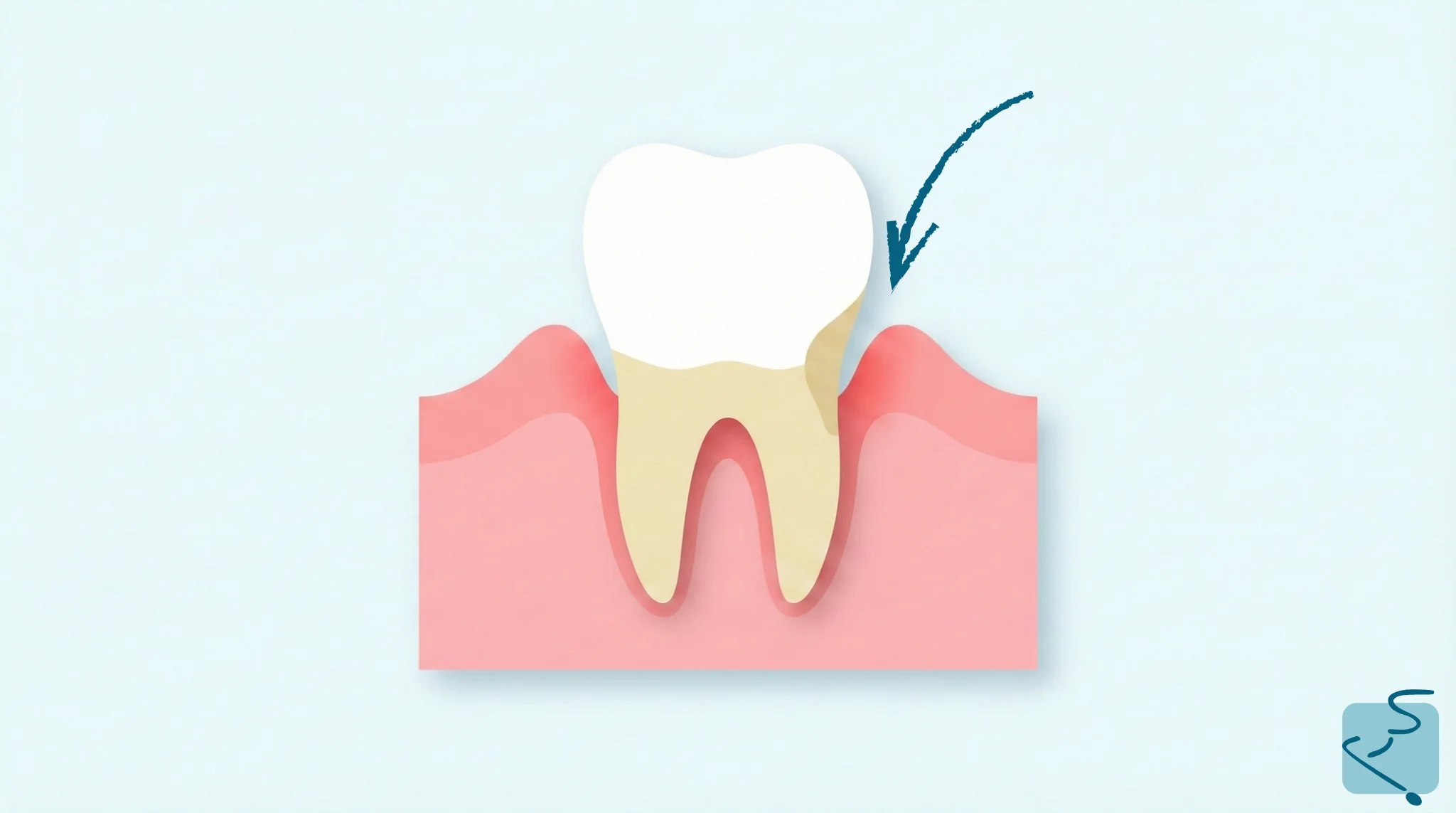 Soluciones a una raiz expuesta