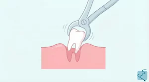 Extracción dientes sevilla