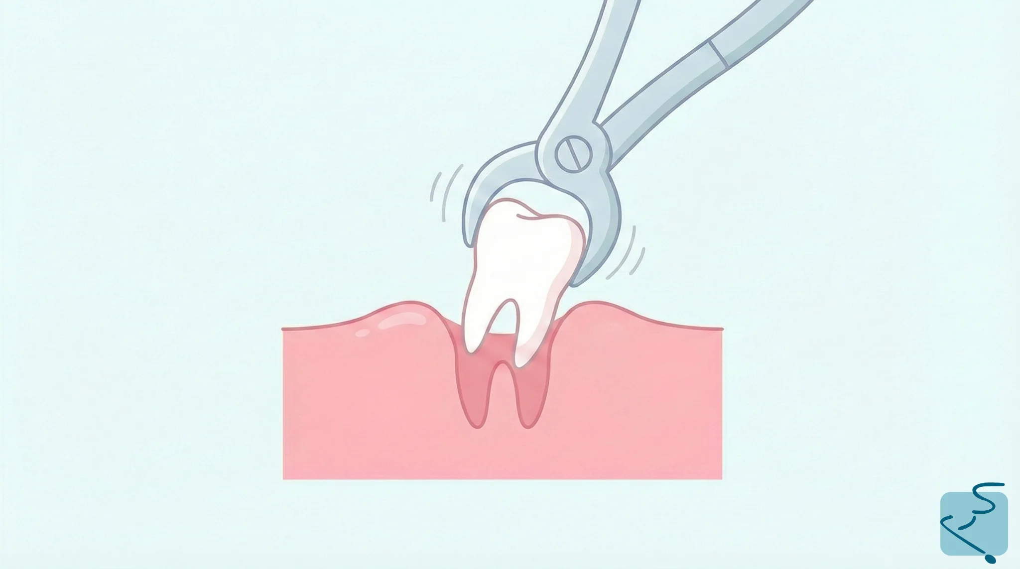 Extracción dientes sevilla