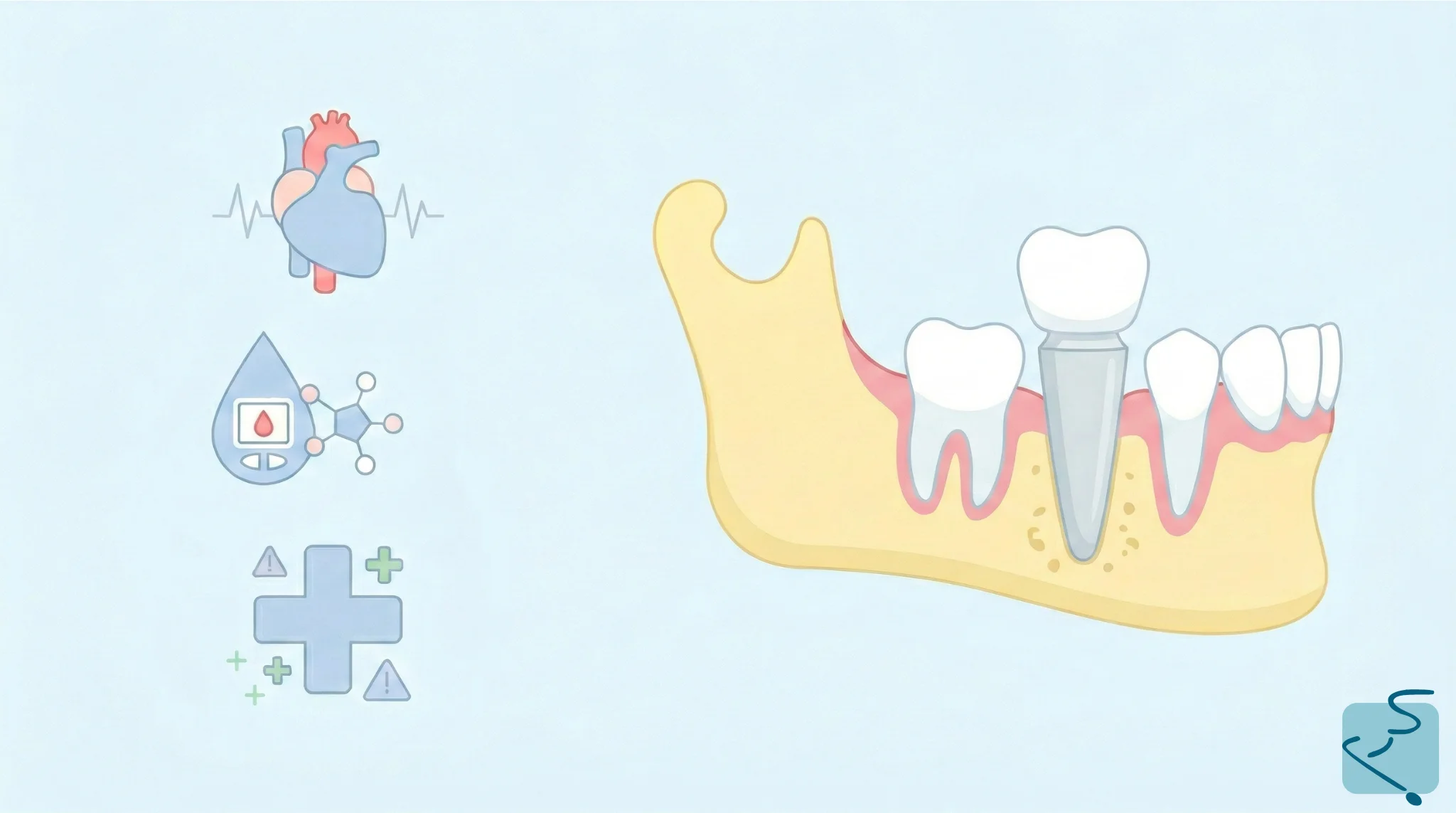 Implantes dentales pacientes con enfermedades sistémicas