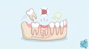 Alveolitis